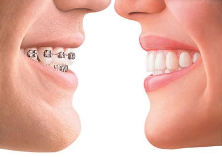 orthodontics and Dentist | Simon Pong Oakville Dental