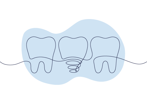 Three outlined teeth are connected by a single line against a blue background, forming a simple and stylized dental-themed illustration.