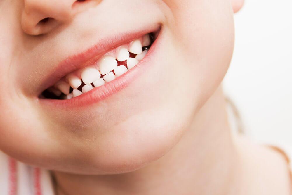 Close-up of a smiling child's face showing teeth. The background is plain, emphasizing the joyful expression and white teeth.