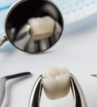 Wisdom Teeth Removals: What to Expect