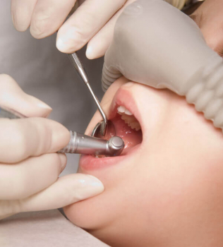 Laughing Gas & Dental Procedures