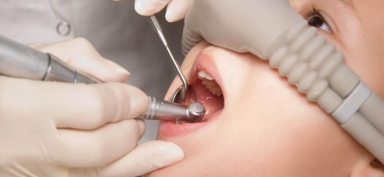 Laughing Gas & Dental Procedures