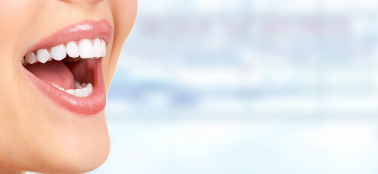 5 Tips For Teeth Whitening