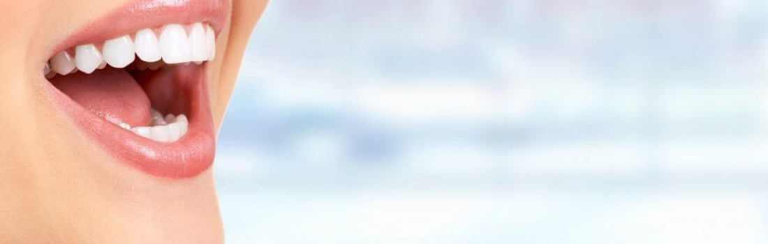 5 Tips For Teeth Whitening