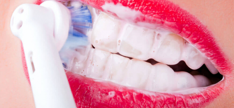 My gums bleed, is this normal?