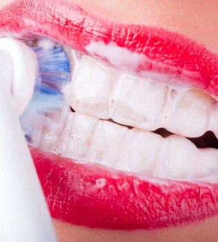 My gums bleed, is this normal?
